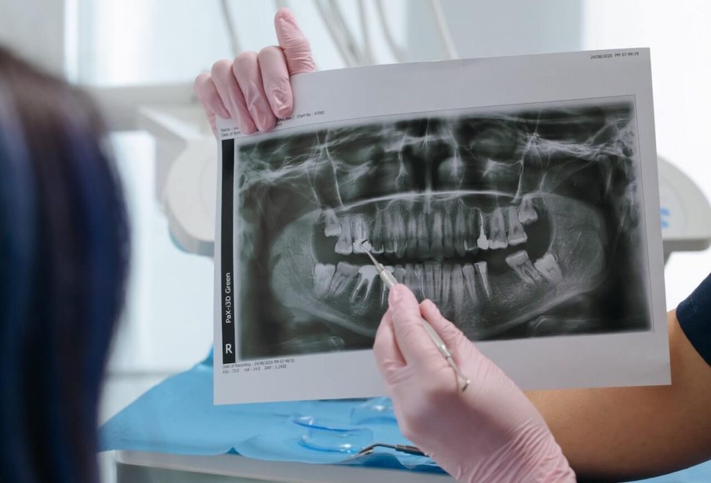 X-Rays-Langley-Dental-1024x696